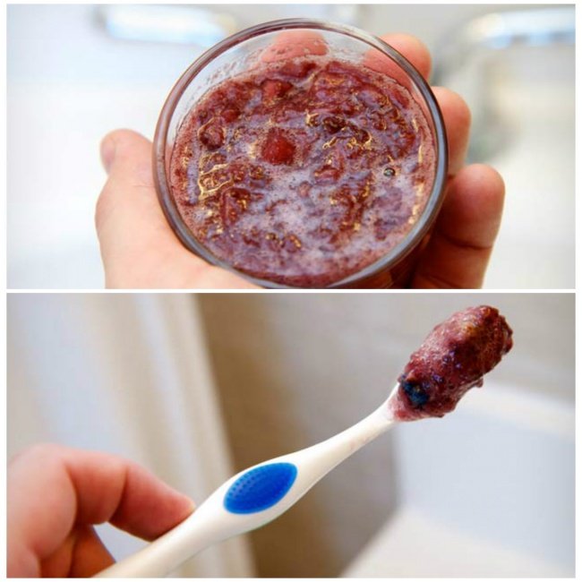 9 simple tips for perfect smiles like Hollywood stars Picture 3