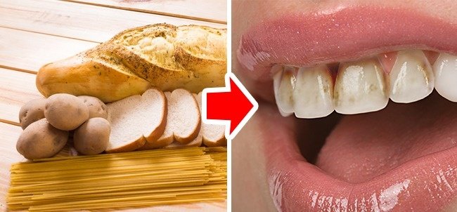 Check out 10 types of special foods that are harmful to teeth Picture 10