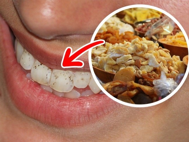 Check out 10 types of special foods that are harmful to teeth Picture 11