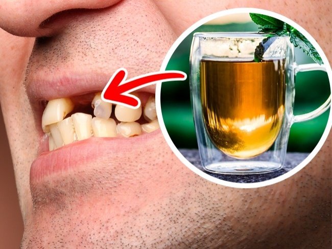 Check out 10 types of special foods that are harmful to teeth Picture 12