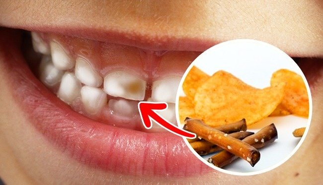 Check out 10 types of special foods that are harmful to teeth Picture 6
