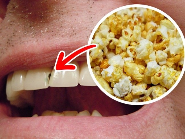 Check out 10 types of special foods that are harmful to teeth Picture 8