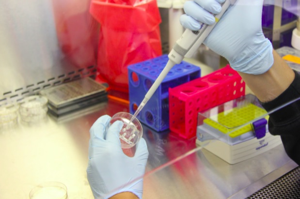 Picture 2 of The 4 Basic Steps Of Protein Expression And Purification Explained