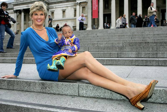 10 rare records are unbelievable about the human body Picture 10