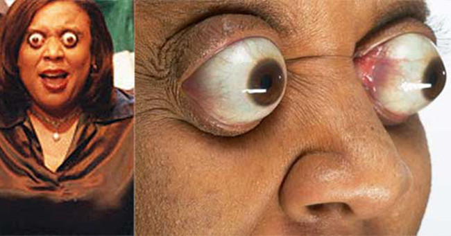 10 rare records are unbelievable about the human body Picture 9