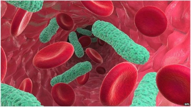 10 reasons why antibiotic resistance is scary right now Picture 8