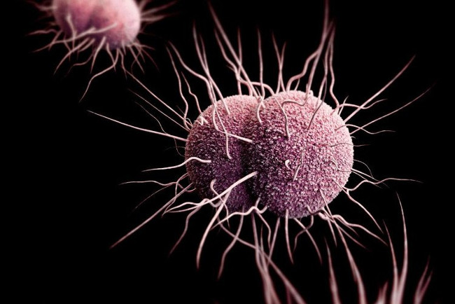 10 reasons why antibiotic resistance is scary right now Picture 9