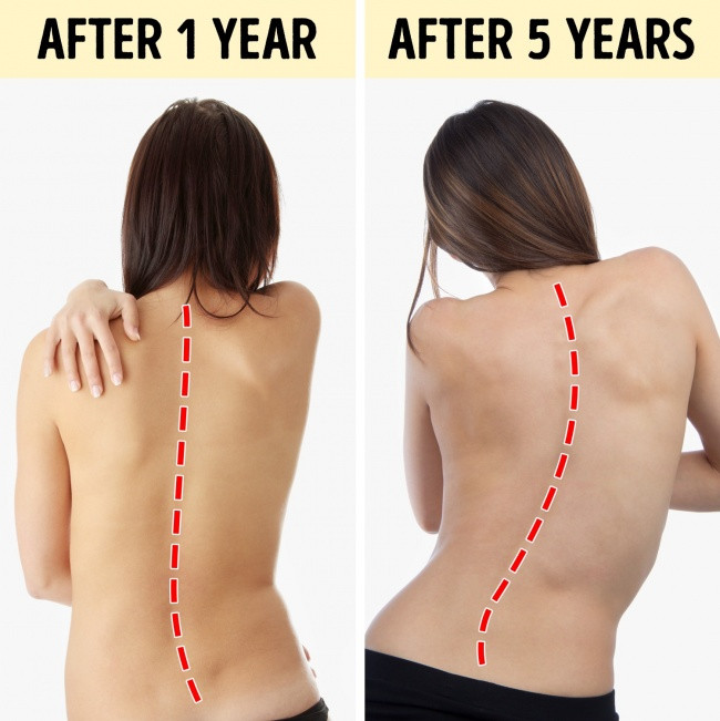 10 serious harms will happen if you sit for 8 hours a day Picture 1