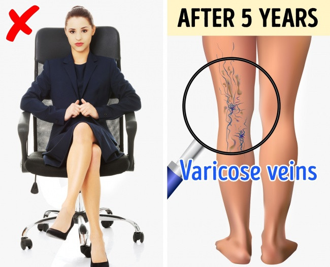 10 serious harms will happen if you sit for 8 hours a day Picture 4