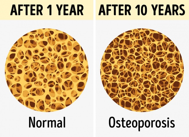 10 serious harms will happen if you sit for 8 hours a day Picture 6