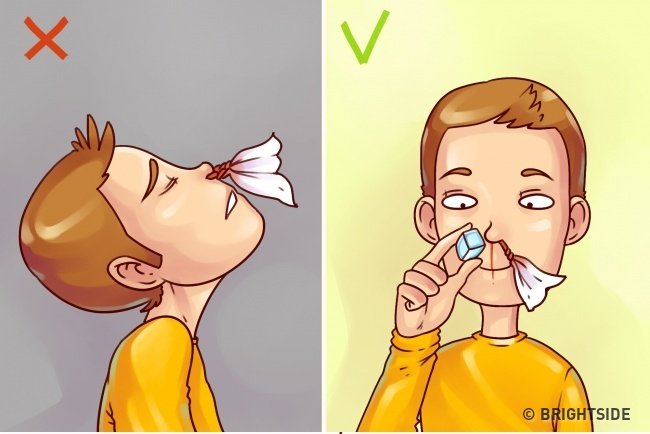 10 simple first aid tips but 90% of people still do wrong Picture 4