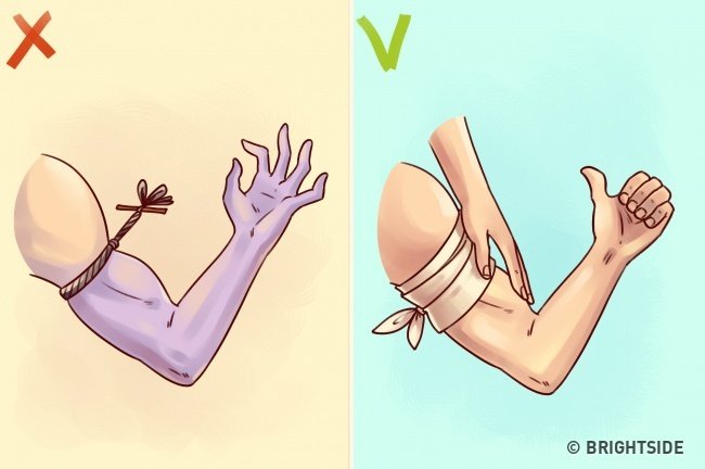 10 simple first aid tips but 90% of people still do wrong Picture 7