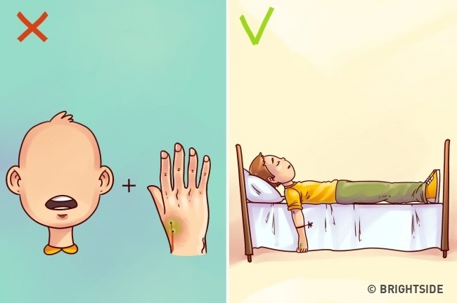 10 simple first aid tips but 90% of people still do wrong Picture 9