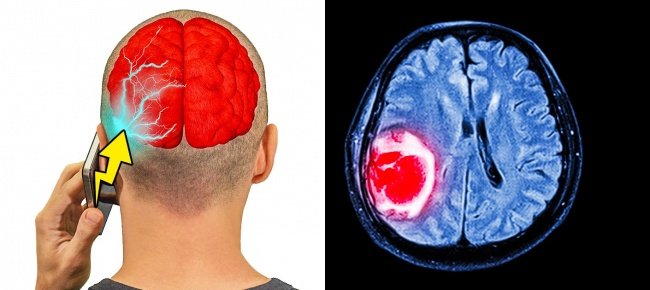 13 unexpected habits can harm the brain Picture 7