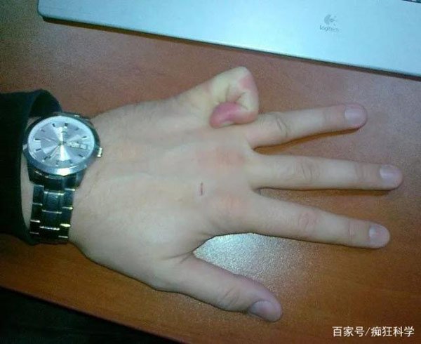 14 rare 'super powers' of humans Picture 13