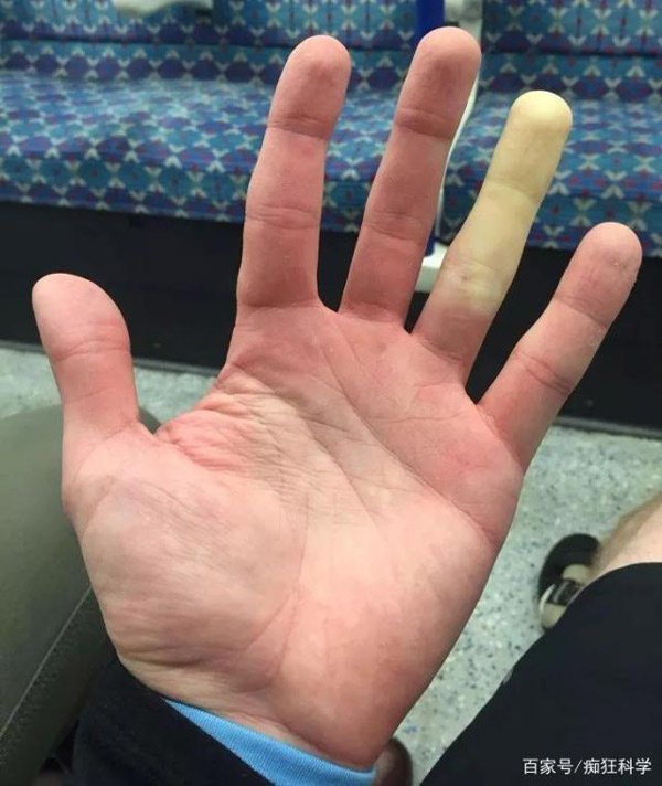 14 rare 'super powers' of humans Picture 4