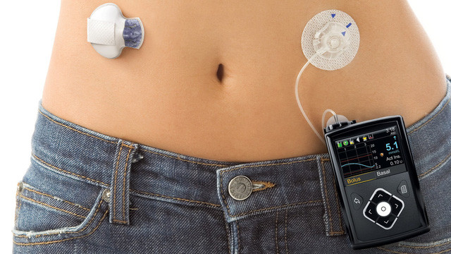 15 best inventions of 2016 (part 2) Picture 4