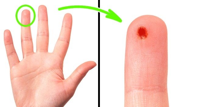 19 familiar phenomenon that everyone can see but 'lazy to ask Google doctor' why Picture 17