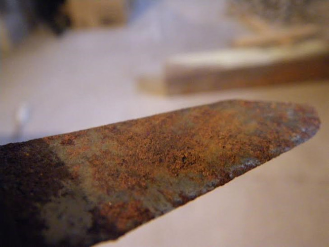 20 types of strange objects discovered in the human body make you 'floaters' Picture 3