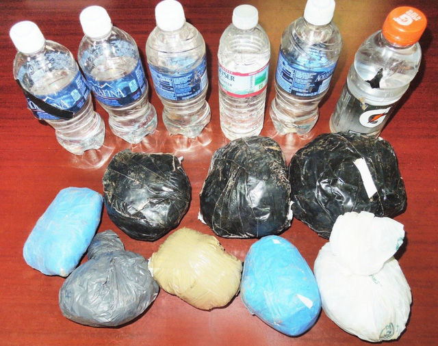 20 types of strange objects discovered in the human body make you 'floaters' Picture 9