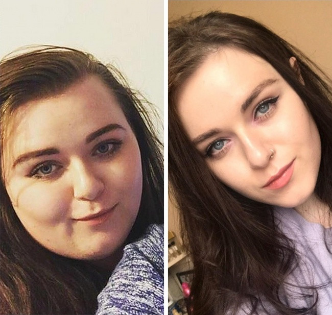 25 images turn into another person after successful weight loss Picture 16