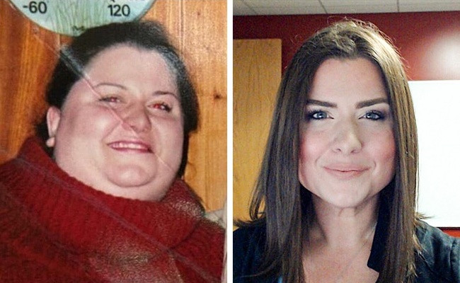 25 images turn into another person after successful weight loss Picture 19