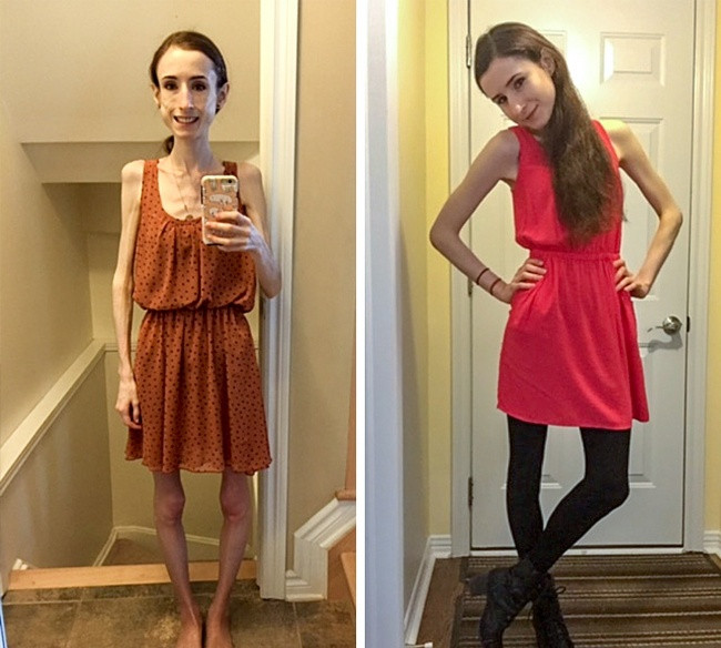 25 images turn into another person after successful weight loss Picture 8