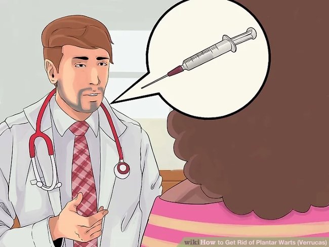 3 methods that treat permanent foot warts that are simple Picture 10