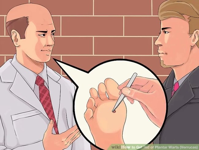 3 methods that treat permanent foot warts that are simple Picture 11