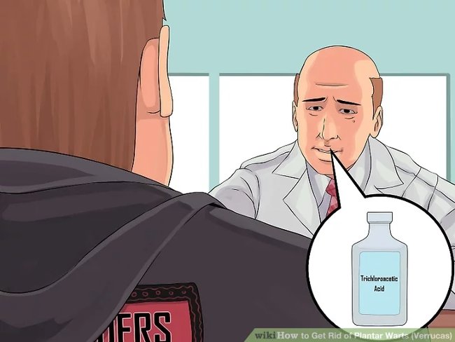 3 methods that treat permanent foot warts that are simple Picture 7