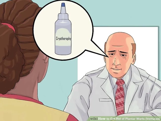 3 methods that treat permanent foot warts that are simple Picture 8