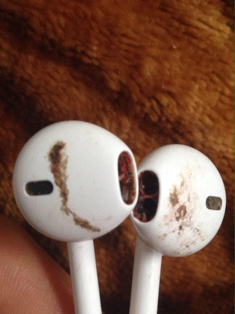 3 reasons why you should never borrow or lend a headset Picture 11