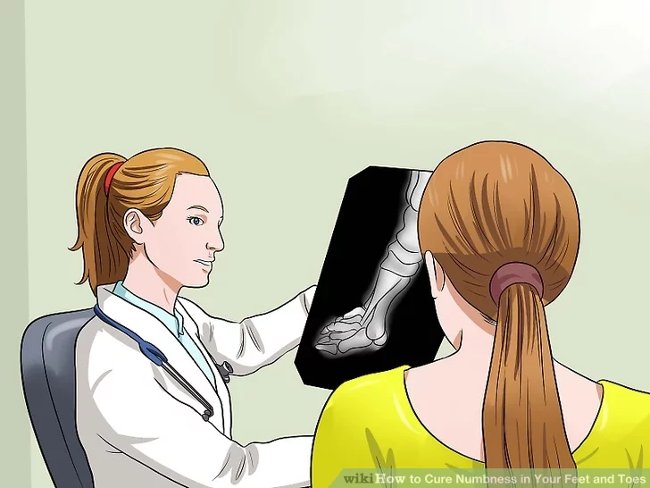 3 simple ways to treat numbness of the feet and toes Picture 14