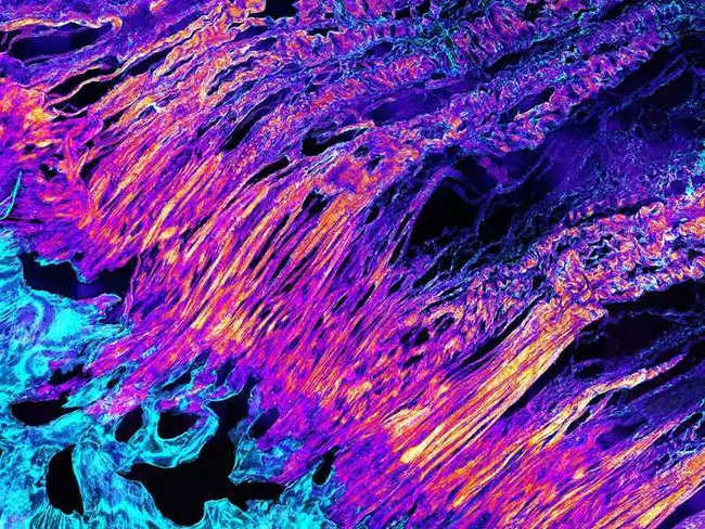 3D images show how the heel tendon in our body is? Picture 1