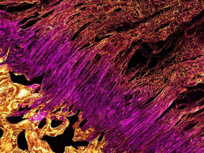 3D images show how the heel tendon in our body is? Picture 3