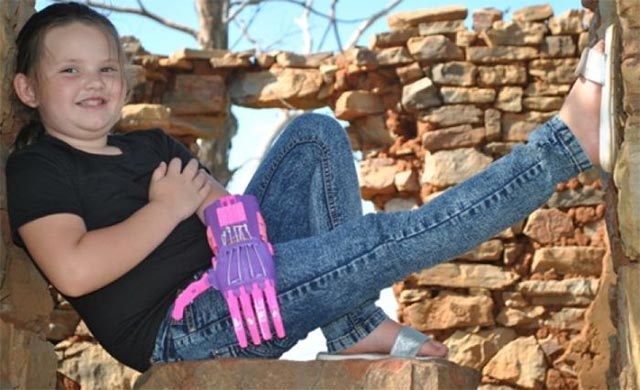 3D printing technology - 'angel' of unhappy lives Picture 2