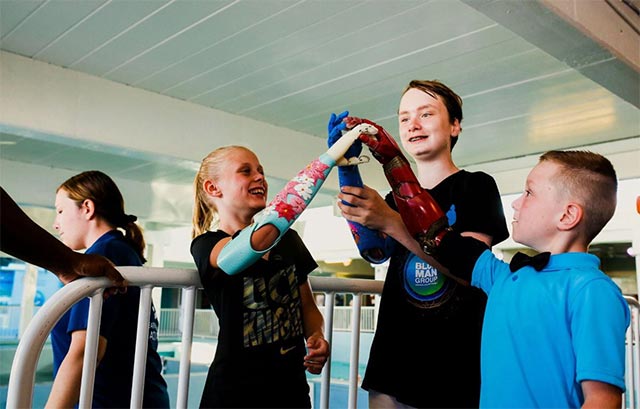 3D printing technology - 'angel' of unhappy lives Picture 3