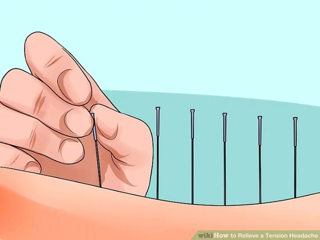 4 simple methods to effectively relieve muscle tension headaches Picture 3