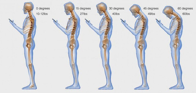 4 ways to eliminate 'technology sickness', protect your spine and spine Picture 3