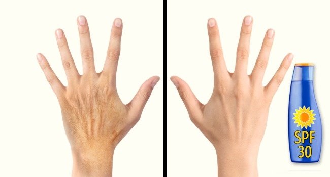 5 bad habits make your hands older than your face to 10 years old Picture 5
