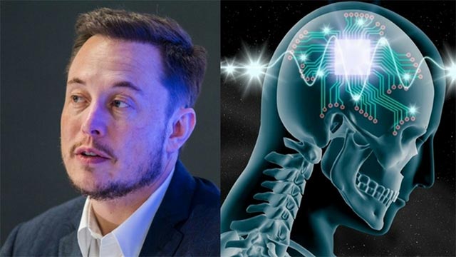 5 big questions about technology that connects the brain that Elon Musk is developing in Neuralink, transcendence or a dark script? Picture 1