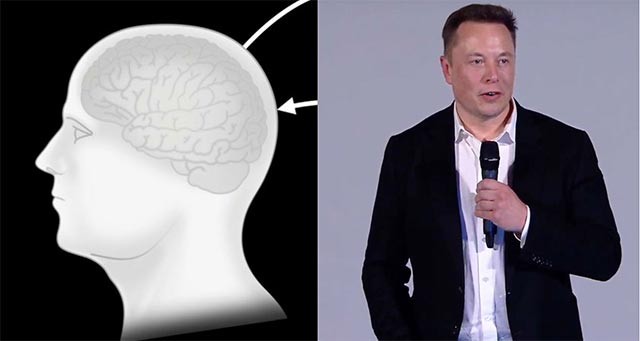 5 big questions about technology that connects the brain that Elon Musk is developing in Neuralink, transcendence or a dark script? Picture 4