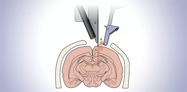 5 big questions about technology that connects the brain that Elon Musk is developing in Neuralink, transcendence or a dark script? Picture 5