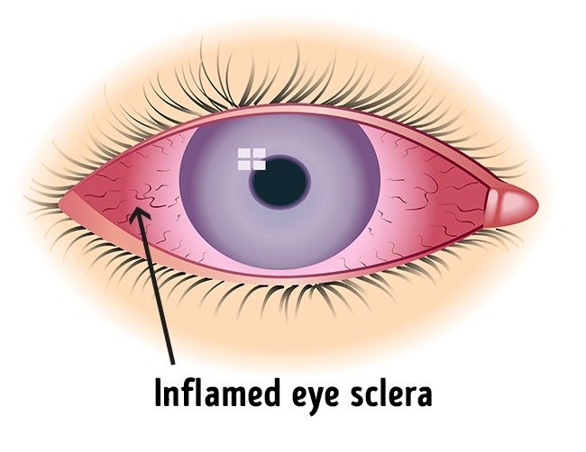 5 daily jobs are thought to be harmful to your health Picture 4