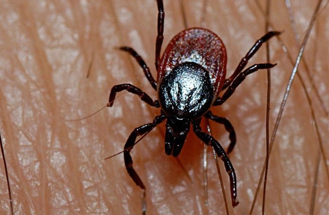 5 'extremely dangerous' diseases can be deadly Picture 4