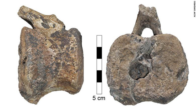 66 million-year-old dinosaur fossils contain a rare disease in modern-day children Picture 1