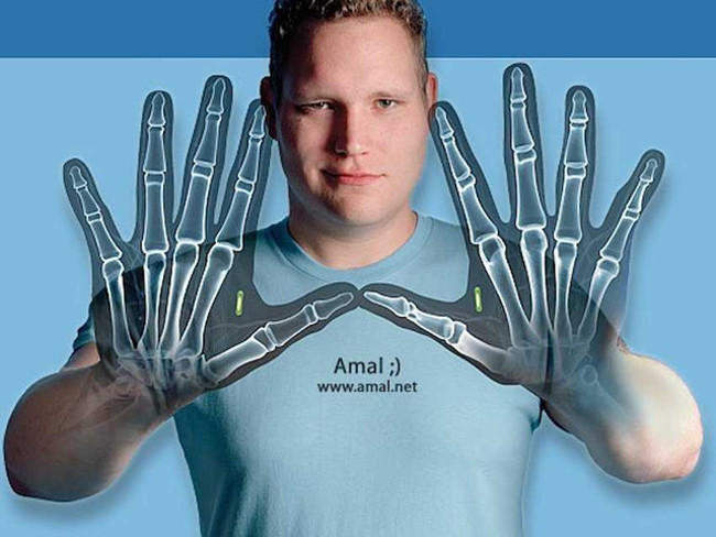 7 people have 'hacked' their own bodies to have the same power as machines Picture 3