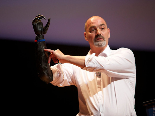 7 people have 'hacked' their own bodies to have the same power as machines Picture 5