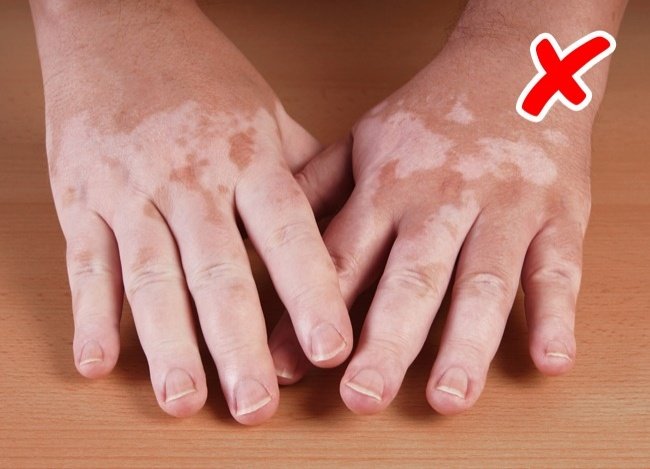 8 abnormal signs on the skin warning the body is having serious health problems Picture 2
