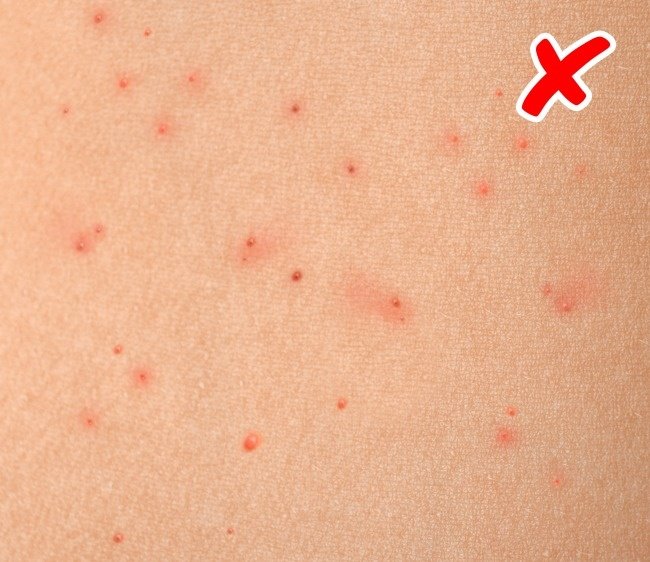 8 abnormal signs on the skin warning the body is having serious health problems Picture 3